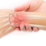 Broken VS Sprained Wrist