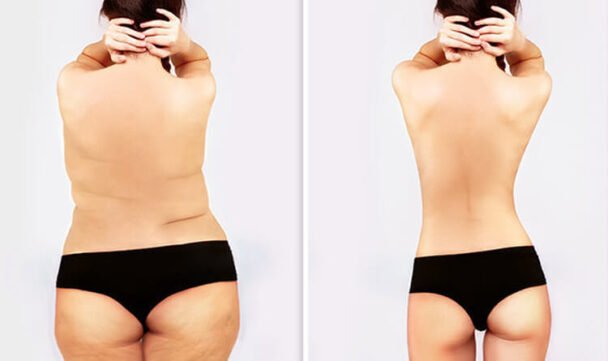 Role of Exercise in a weight loss program 7 Role of Exercise in a weight loss program 1